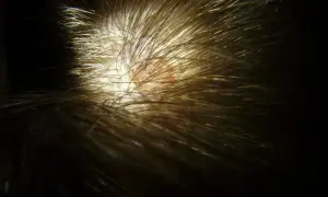 Närbild på hårbotten med en fläck som kan vara svamp i hårbotten. Håret är brunt och glansigt.