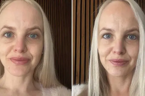 Före och efter-bilder visar hur en kvinna lyckas applicera brun utan sol i ansiktet för en jämnare hudton.