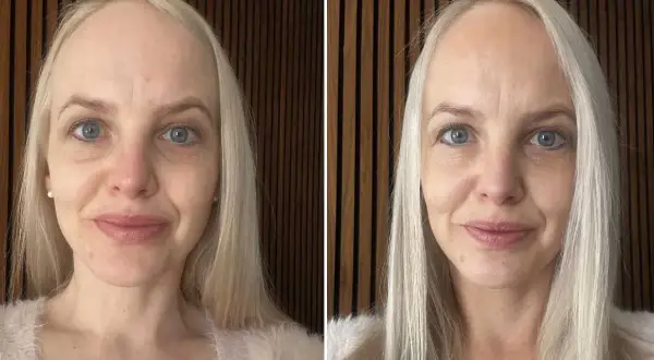 Före och efter-bilder visar hur en kvinna lyckas applicera brun utan sol i ansiktet för en jämnare hudton.