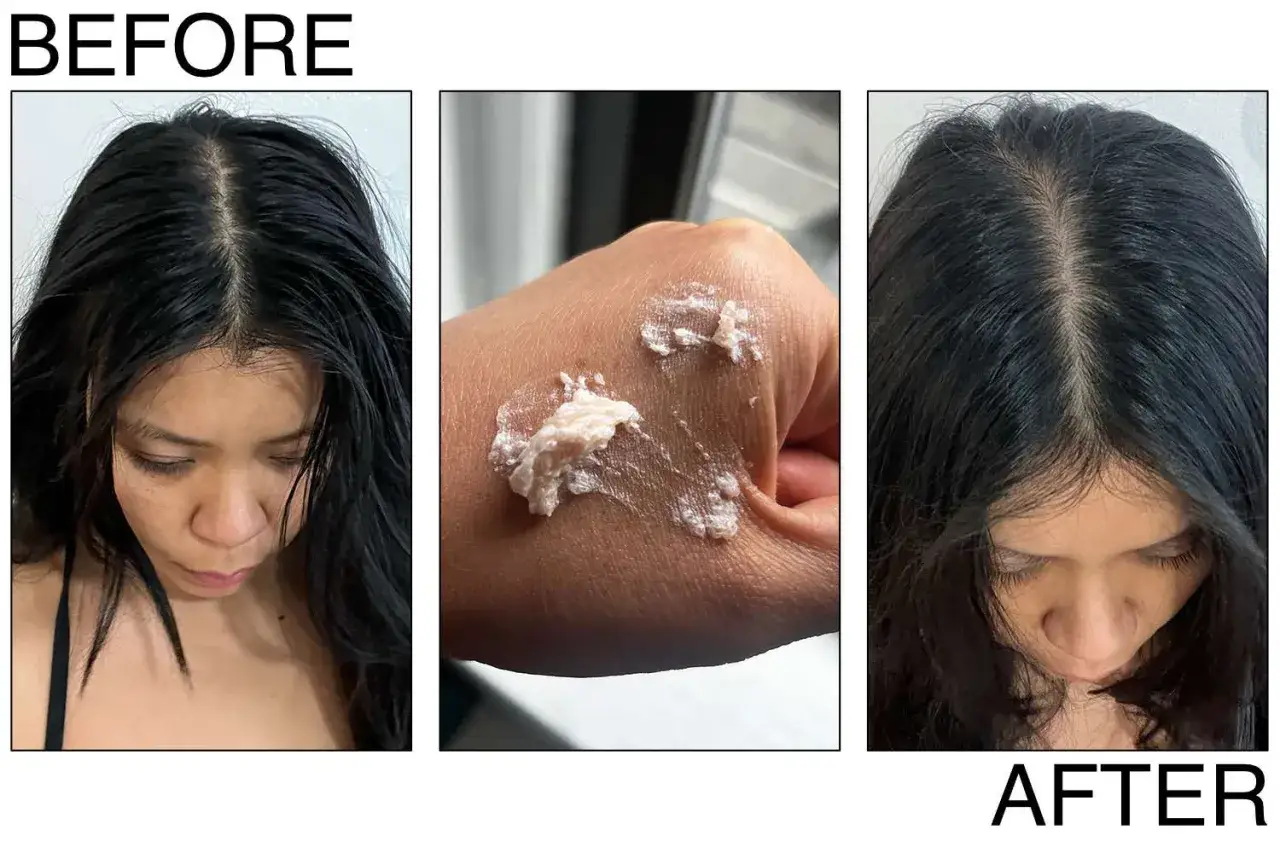 F&ouml;re och efter-bilder visar en kvinna som anv&auml;nder en produkt f&ouml;r att exfoliera h&aring;rbotten. En kr&auml;mig produkt visas p&aring; handen.