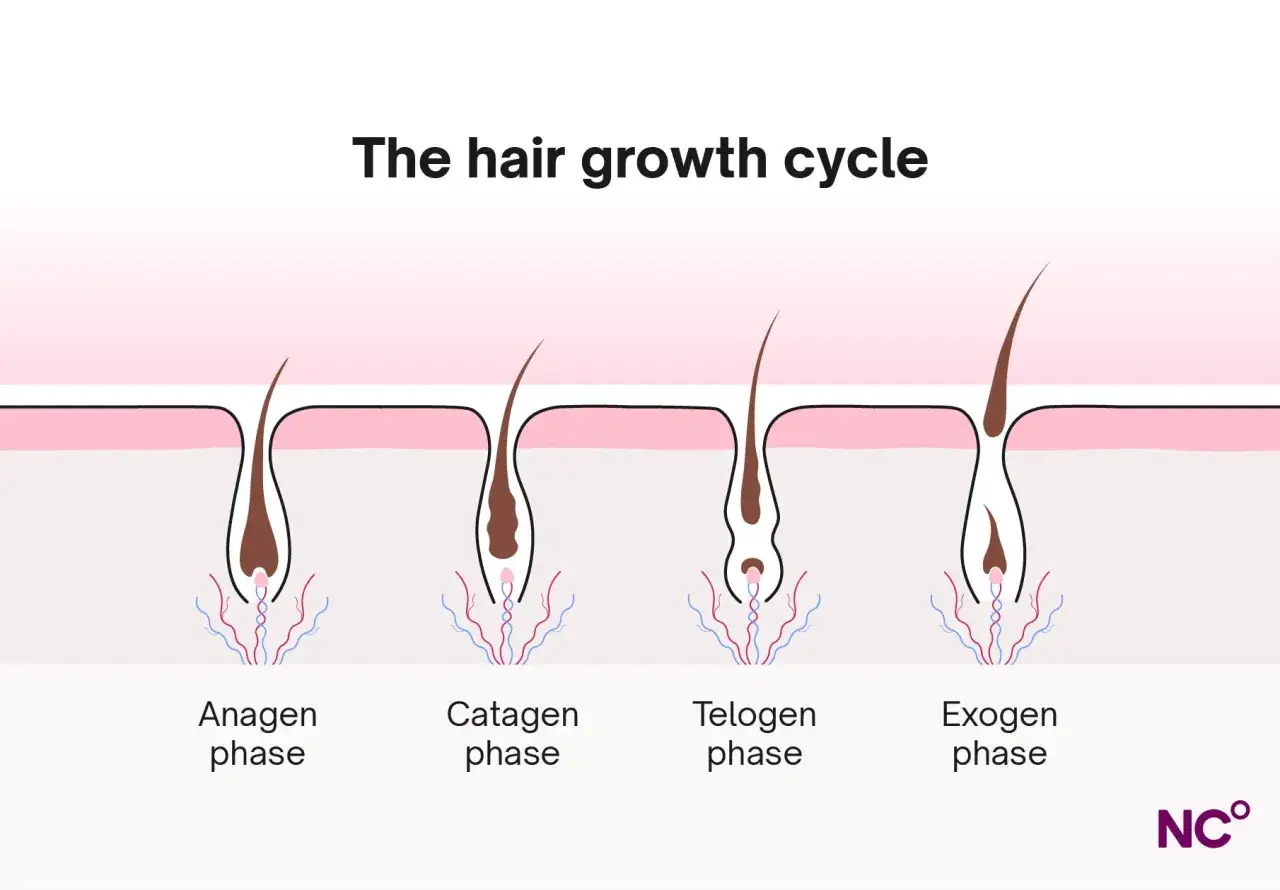 Illustration av h&aring;rtillv&auml;xtcykeln, fr&aring;n aktiv till vilande fas. Hormoner kan p&aring;verka detta, ibland leda till fett h&aring;r.